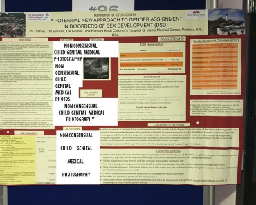 Owning Endosex Privilege and Supporting the Intersex Community: WPATH, Intersex Genital Mutilation (IGM), and Sex Variant Bodies